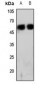 Anti-CD224 HC Antibody