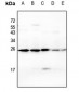 Anti-CD269 Antibody