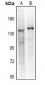 Anti-CD41 HC Antibody