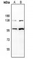 Anti-CD85j Antibody