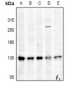 Anti-Collagen 1 alpha 1 Antibody