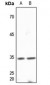 Anti-DNAJB2 Antibody