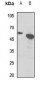 Anti-EB2 Antibody