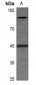 Anti-EIF2S2 (pS67) Antibody
