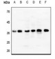 Anti-ENT2 Antibody