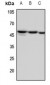 Anti-Factor IX LC Antibody