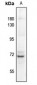 Anti-Factor XI LC Antibody