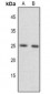 Anti-FGF17 Antibody