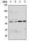 Anti-FILTRIN Antibody