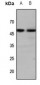 Anti-GALR1 Antibody