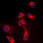 Anti-GPR116 Antibody