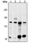 Anti-GPR116 Antibody