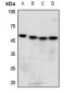 Anti-GPR13 Antibody