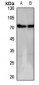 Anti-GPR152 Antibody