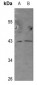 Anti-GPR54 Antibody