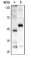 Anti-GPR85 Antibody