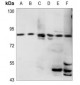 Anti-HSD17B4 Antibody