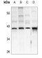 Anti-IDH3 beta Antibody