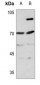 Anti-ITIH4 70k Antibody