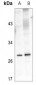 Anti-Kallikrein 4 Antibody