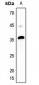 Anti-MASP1 LC Antibody