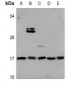 Anti-M-CSF Antibody