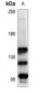 Anti-mGLUR1 Antibody