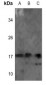 Anti-NDUFB7 Antibody