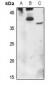 Anti-Orosomucoid 1 Antibody