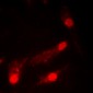 Anti-p53 (AcK386) Antibody