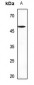 Anti-Septin 8 Antibody