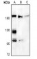 Anti-A2M Antibody