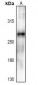 Anti-ACC alpha (pS80) Antibody