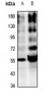 Anti-Alpha-2A Adrenergic Receptor Antibody