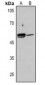 Anti-ALDH1A1 Antibody