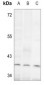 Anti-ALDOC Antibody