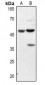 Anti-Annexin A7 Antibody
