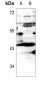 Anti-Apolipoprotein L1 Antibody