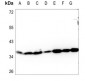 Anti-Apolipoprotein L3 Antibody