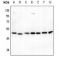 Anti-ATG4B Antibody