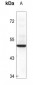 Anti-BAG1 Antibody