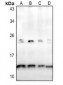 Anti-Osteocalcin Antibody