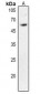 Anti-CD292 Antibody