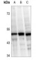 Anti-Caspase 2 Antibody