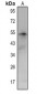 Anti-CCR4 Antibody