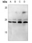 Anti-CD247 Antibody