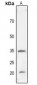 Anti-CD274 Antibody