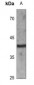Anti-CD72 Antibody