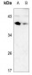 Anti-CD79b Antibody