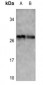 Anti-p27 Kip1 (pT187) Antibody